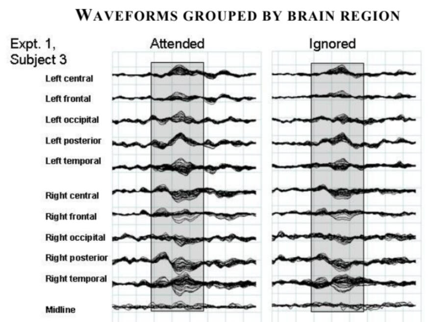 Detecting consciousness in locked-in children and adults: a neuroscience method that helped recognize awareness in a seeming comatose patient